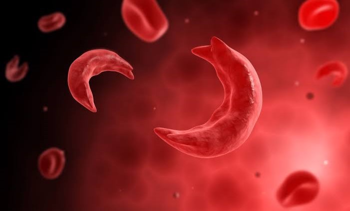 RNCDA launches campaign to raise awareness of sickle cell disease